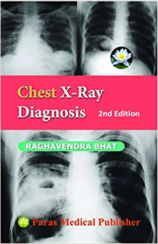 Chest X - Ray Diagnosis 2nd Edition 2012 By Raghavendra Bhat