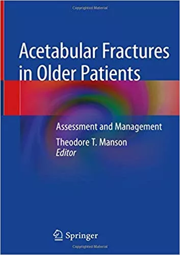 Acetabular Fractures in Older Patients: Assessment and Management 2020 By Theodore T. Manson