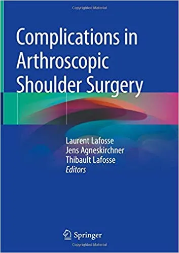 Complications in Arthroscopic Shoulder Surgery 2020 By Laurent Lafosse