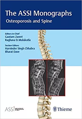 The ASSI Monographs - Osteoporosis and Spine 1st Edition 2019 By Gautam Zaveri
