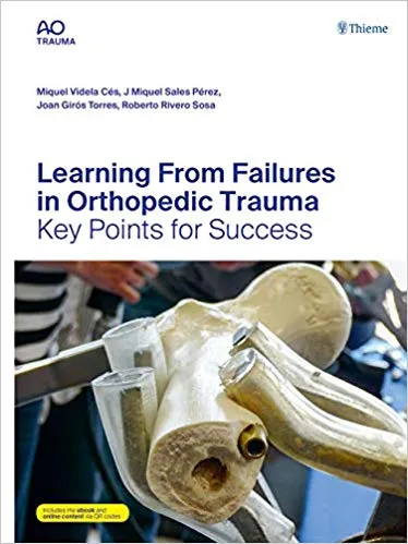 Learning From Failures in Orthopedic Trauma 1st Edition 2020 By Miquel Videla Ces
