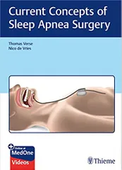Current Concepts of Sleep Apnea Surgery 1st Edition 2019 By Thomas Verse