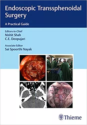 Endoscopic Transsphenoidal Surgery 1st Edition 2018 By Nishit Shah
