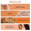 Stretch Marks Prevention Cream 150Ml